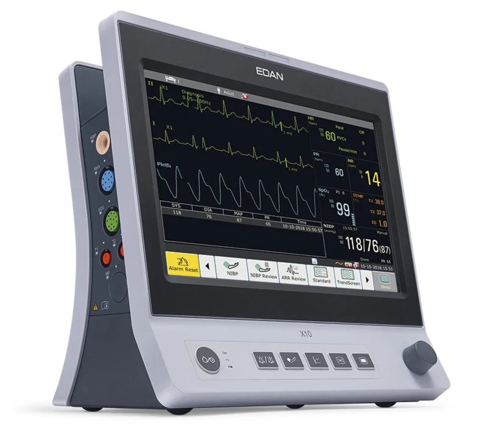 Edan X10 Vet – Veterinär-Patientenmonitor